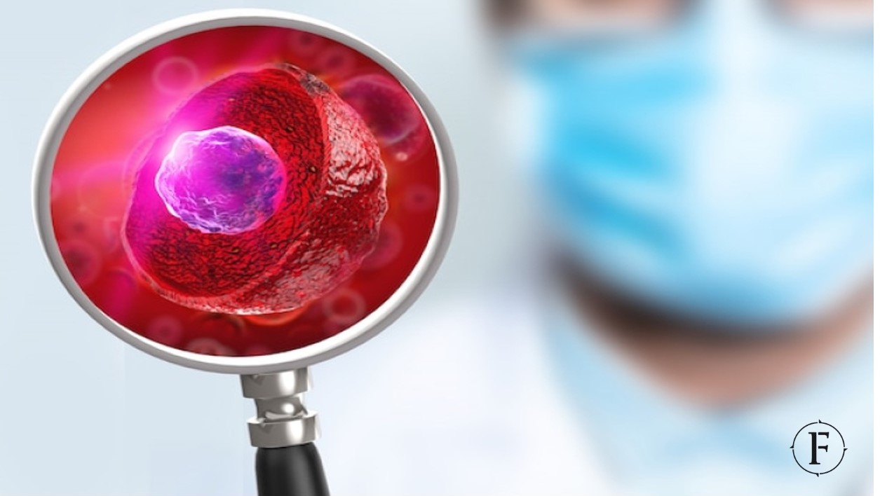 Cancer Diagnostics Market